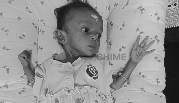 Urgent Help Needed for Sadhanya Sri’s Heart Surgery