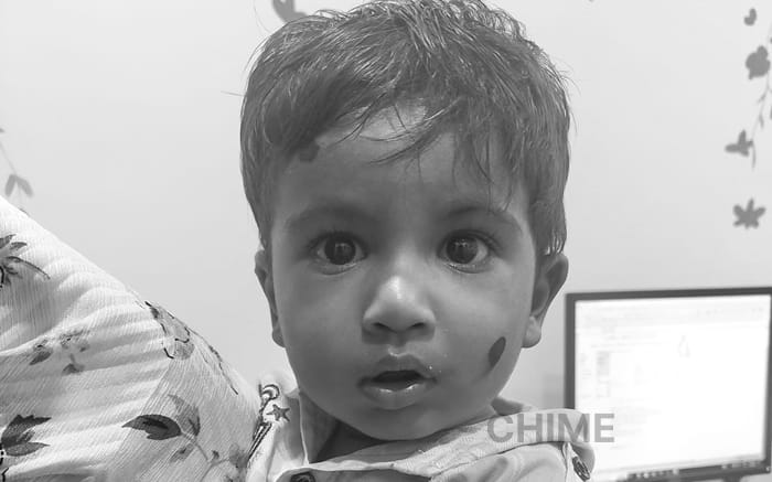 Urgent Help Needed for Baby Mohammed Murshid’s Heart Surgery
