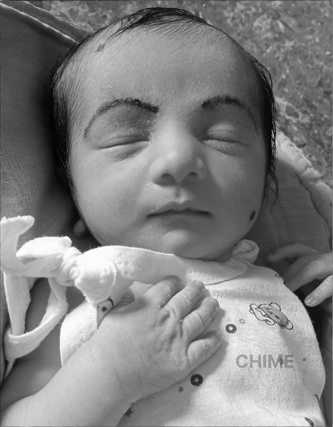 Urgent Funds Needed to Save Faritha’s Life