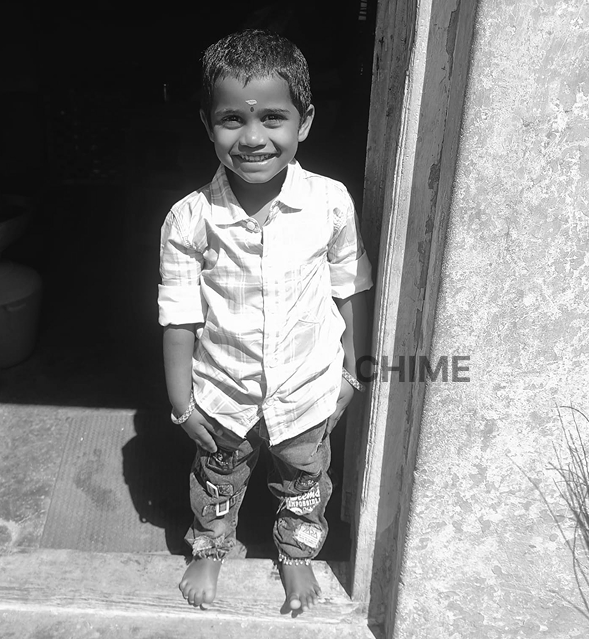 Urgent Funds Needed to Save Miracline Dharshini’S Life