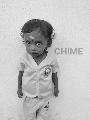Urgent Funds Needed to Save Mokith’s Life