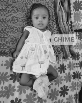 Miracline Riana – A Pediatric Heart Success Story